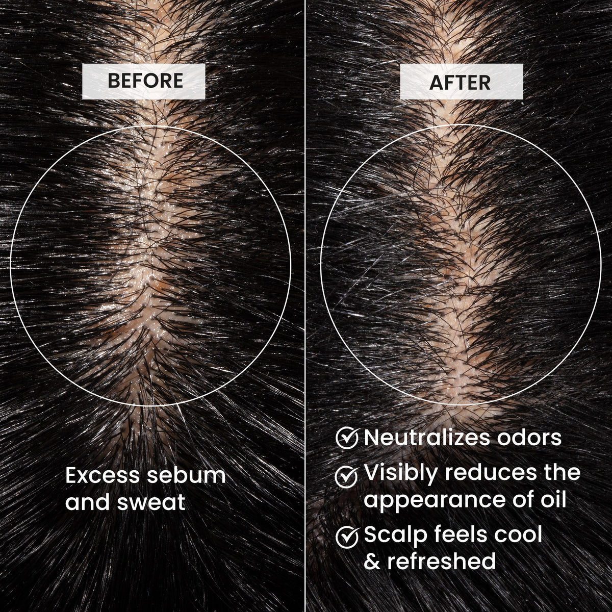 Before and after comparison of scalp with excess sebum and sweat, showing neutralization of odors and reduction of oil.