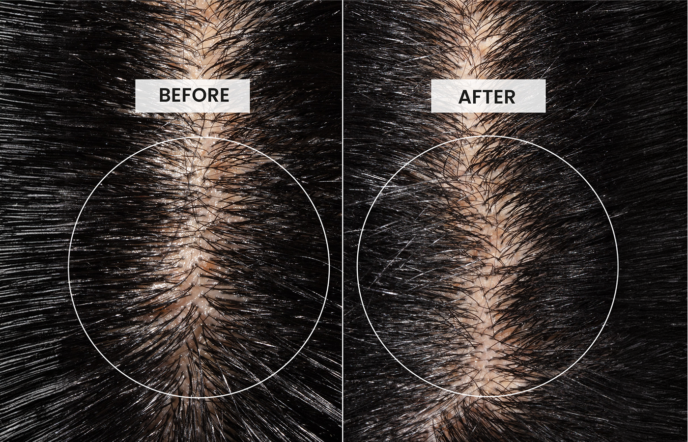 Before and after comparison of hair growth on a black background